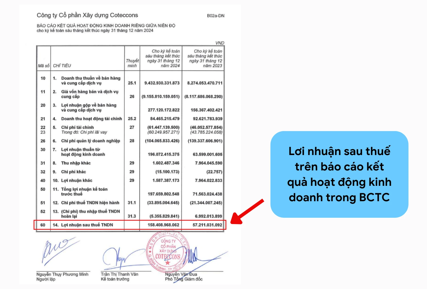 Lợi nhuận sau thuế trên báo cáo kết quả hoạt động kinh doanh của doanh nghiệp
